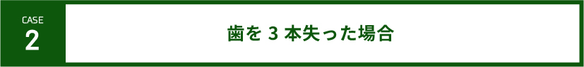 case2-歯を3本失った場合