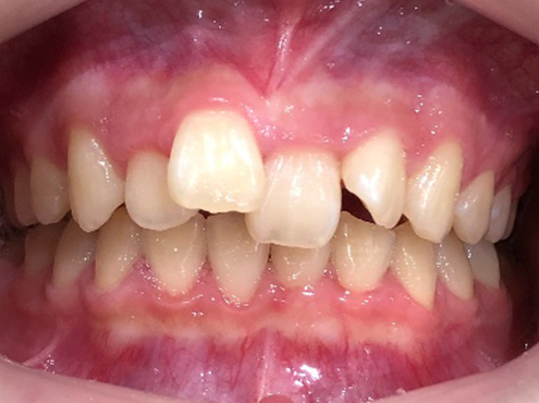 L5-before.jpg