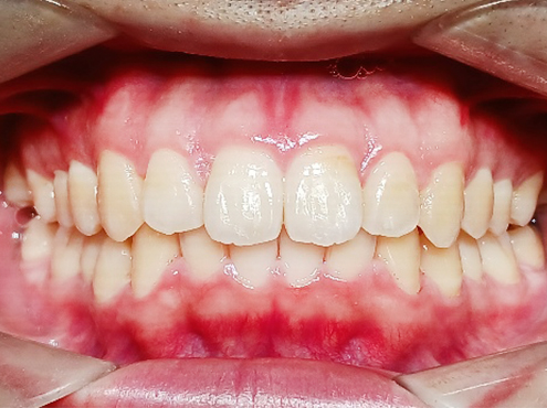 L6-after.jpg