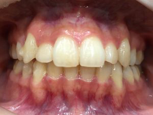 case-5-b-1-2.jpg