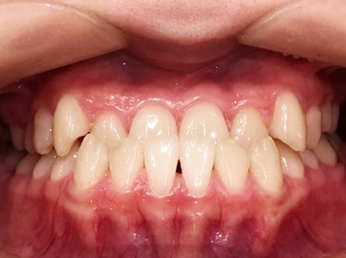 case12-a-1-2.jpg