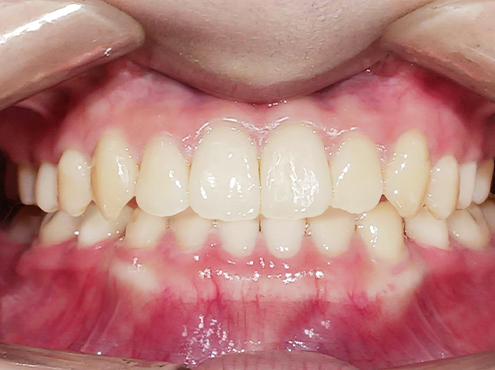 case12-b-2-3.jpg